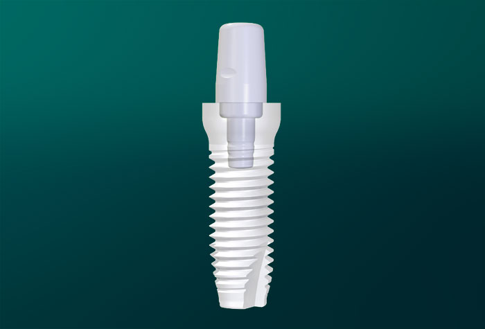Weißes Implantat. Grafikvorlage Zirkolith ®